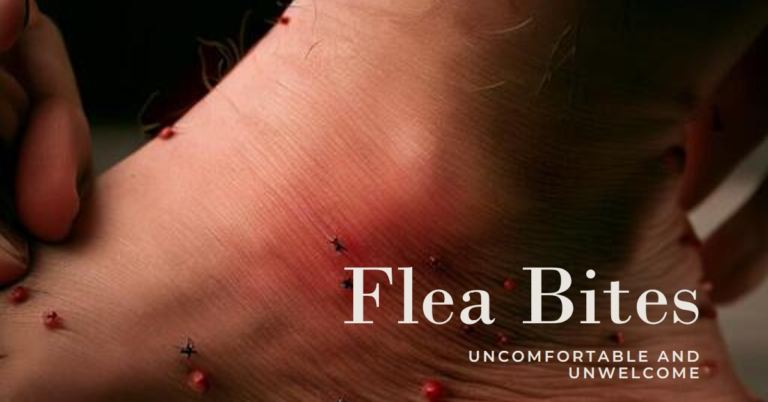 How Long Do Flea Bites Last